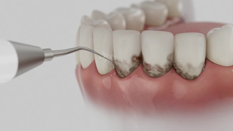 Reliable Dental Implants contractor in Marlboro Meadows, MD by Smile Center Dentistry